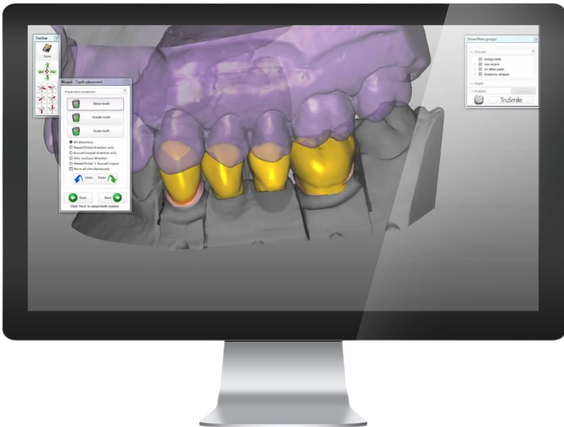GreenAlphaTech TANGLEX™